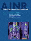 American Journal of Neuroradiology 年間個人購読(オンラインジャーナル) 【購読期間:1月-12月】